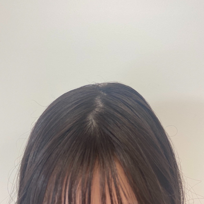 After